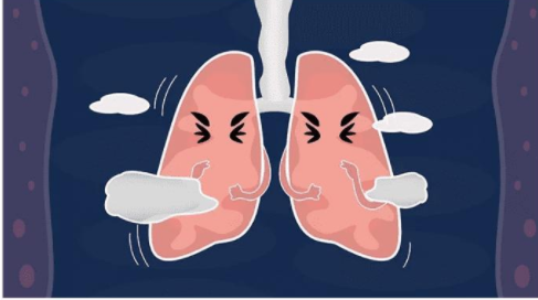 通气,又叫做外呼吸,是指肺与外界进行气体交换,简单的就是指肺组织